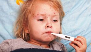 Пускают ли в самолет пассажиров с ветряной оспой